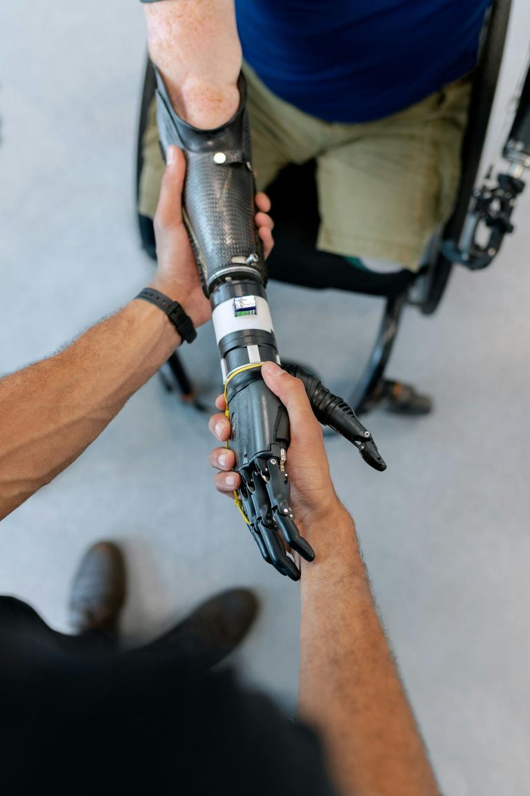 Prosthetic arm being attached.